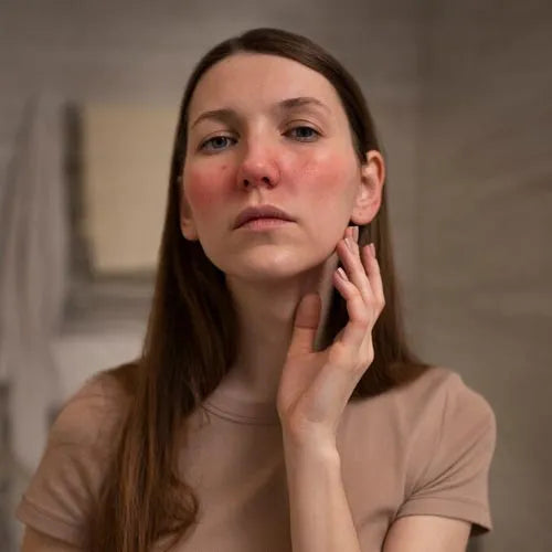 Sensitive Skin